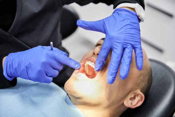Best Emergency Wisdom Teeth Removal in Wapello, IA